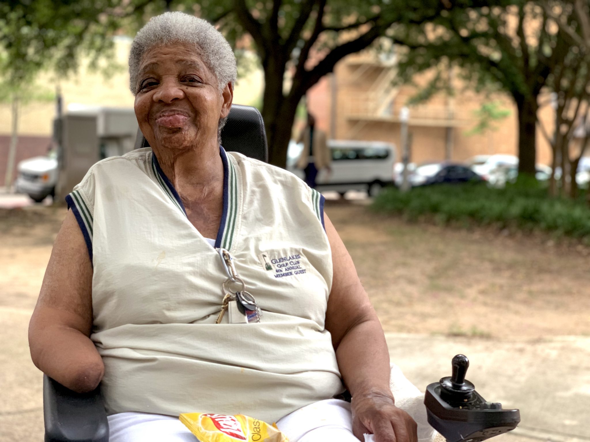 I lost my arm in a house fire fifty years ago